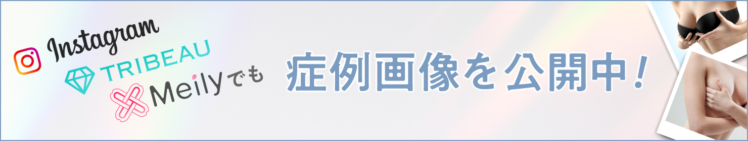 症例画像を公開中！